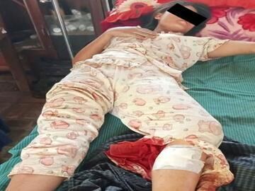 တနင်္သာရီတိုင်းဒေသကြီးနှင့် စစ်ကိုင်းတိုင်းဒေသကြီးတို့ရှိ မြို့နယ်အချို့၌ PDF အမည်ခံ အကြမ်းဖက် သမားများထောင်ထားသည့် မိုင်းများပေါက်ကွဲခဲ့မှုကြောင့် အပြစ်မဲ့ အရပ်သားပြည်သူ သုံးဦး ထိခိုက် ဒဏ်ရာရရှိ